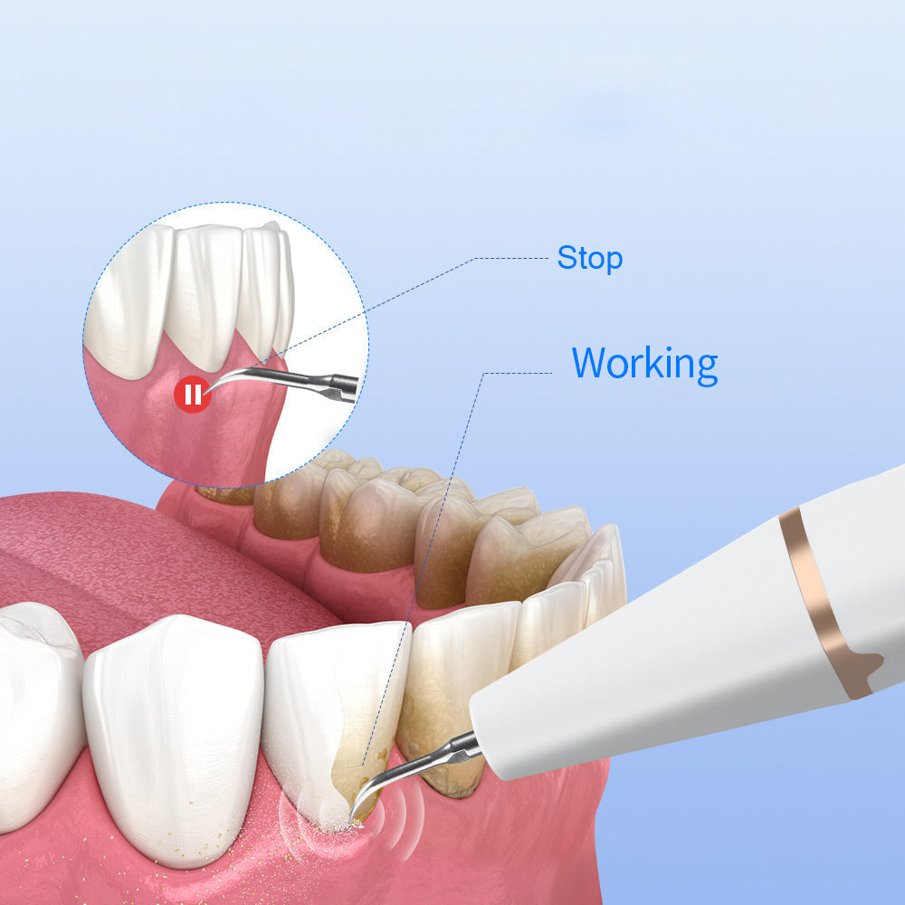 3-Speed Ultrasonic Electric Dental Cleaner with LED Light and Type-C Charging - Professional Plaque Remover Kit-Oral Care-PEROZ Accessories
