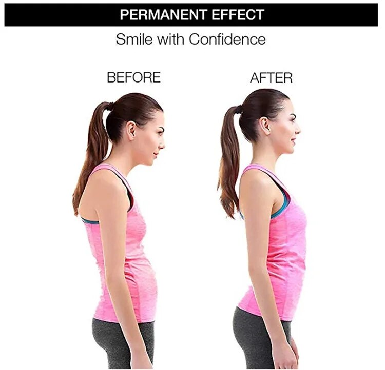 Anyfit Green Corrector Belt Large Back Posture Adjustable Neck Brace Training Equipment Shoulder Support Correction Belt-Corrector Belt-PEROZ Accessories