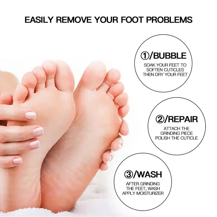 Pink Electric Foot Callus Remover - Portable Pedicure Tool for Smooth Feet-Foot Care-PEROZ Accessories