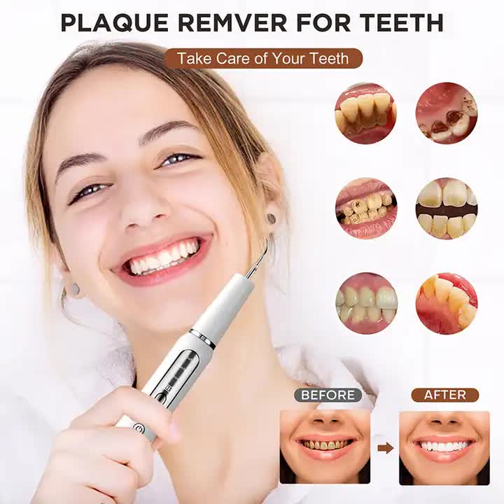 White Portable Ultrasonic Dental Cleaner, Home Use Plaque Remover, Sonic Tooth Stain &amp; Tartar Cleaning Tool-Oral Care-PEROZ Accessories