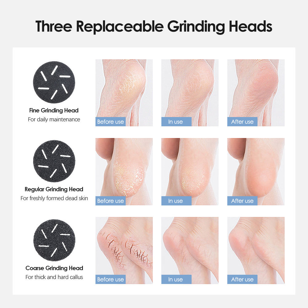 White Rechargeable Electric Foot Grinder with Suction - Complete 10-Piece Pedicure Kit-Foot Care-PEROZ Accessories